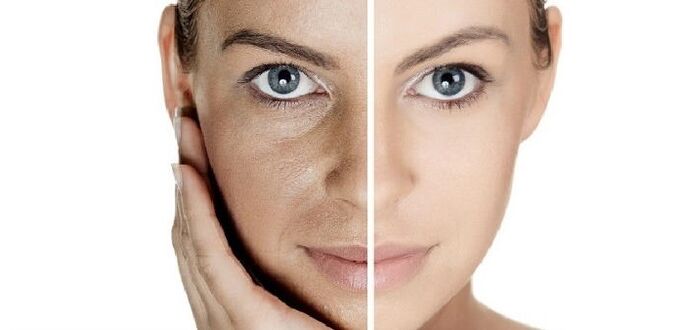 قبل و بعد از جوان سازی پوست صورت