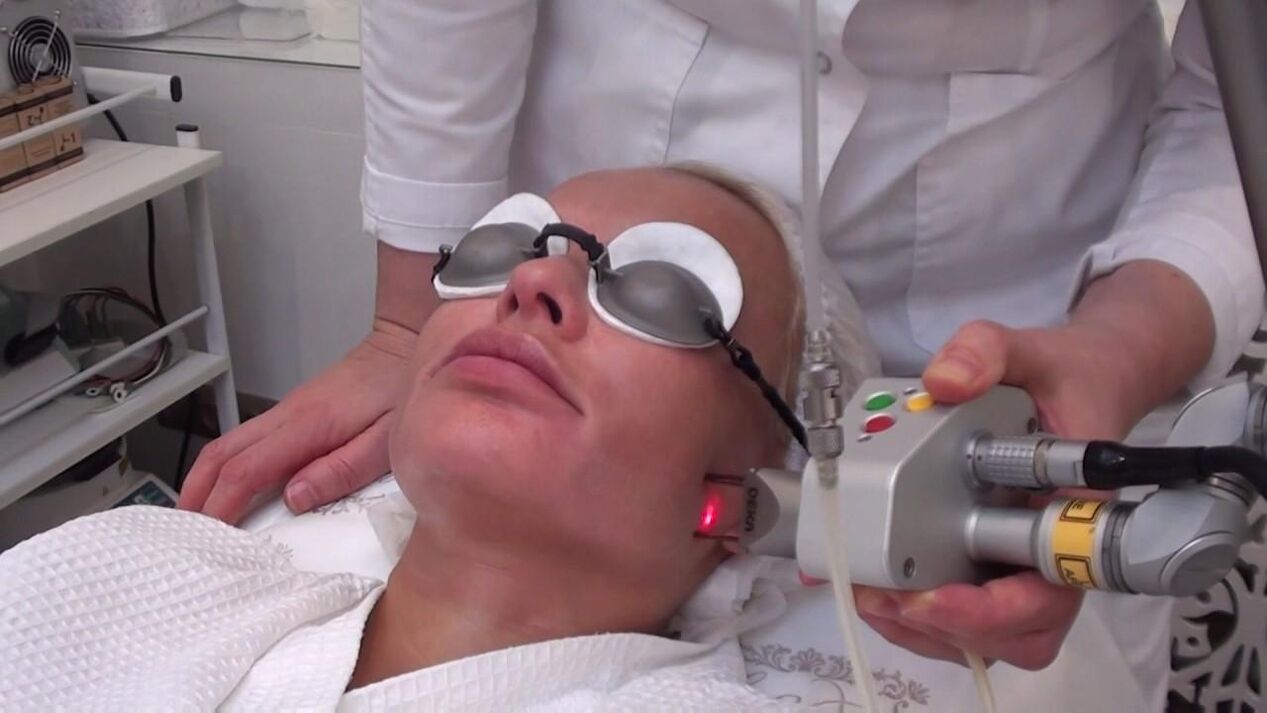 درمان با اشعه لیزر در مناطق مشکل پوست صورت
